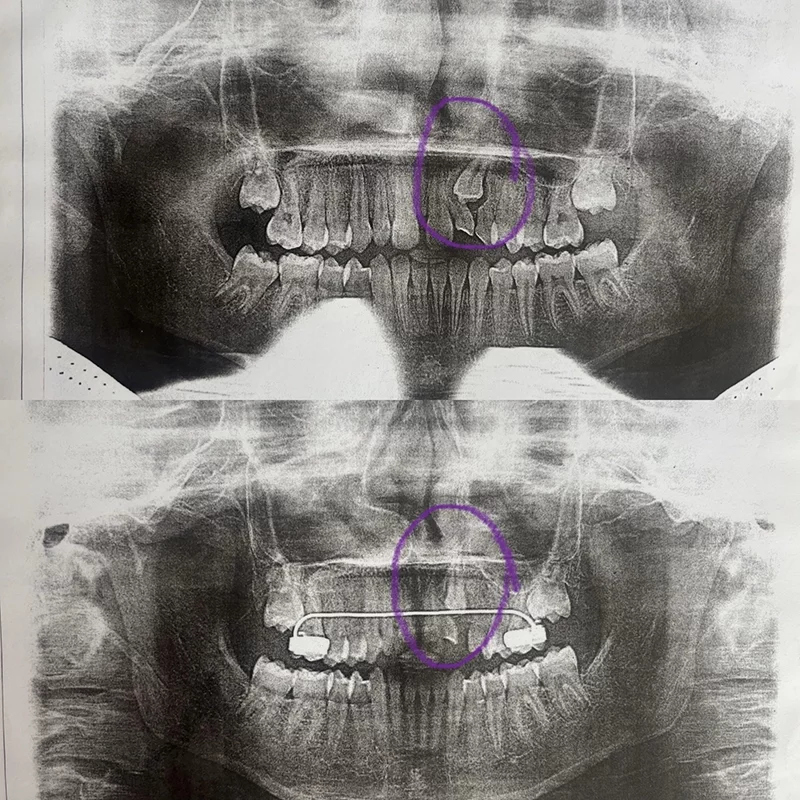 Osteopatia Pediàtrica